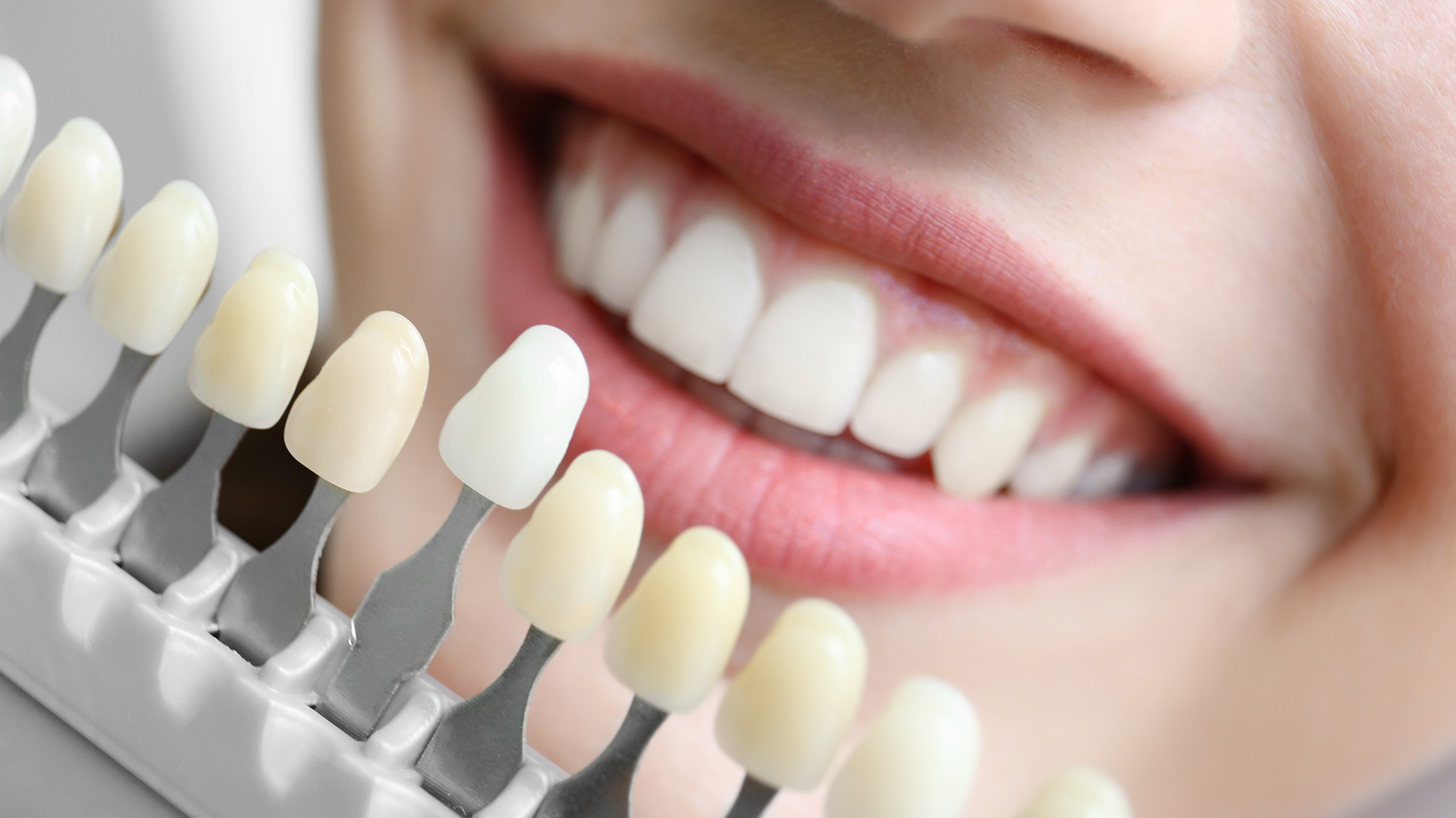 The image shows a smiling person with white teeth, holding a toothbrush with bristles and a small amount of toothpaste, set against a blurred background that suggests a dental care setting.