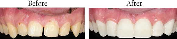 Radburn dental images