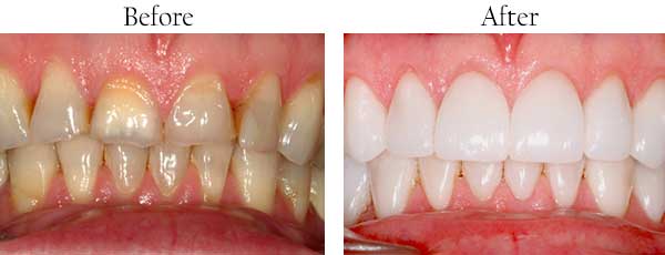 Hawthorne dental images
