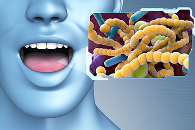 The image displays a 3D rendering of a human mouth with an open mouth, superimposed on a background showing a microscopic view of bacteria and viruses.