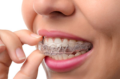 The image shows a person with their mouth open, holding a dental retainer between their teeth, focusing on cleaning or adjusting it while smiling slightly.