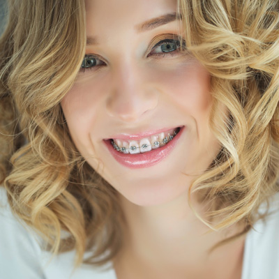 A woman with straightened teeth and braces, smiling at the camera.