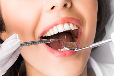 A woman with an open mouth, receiving dental care with a drill visible near her teeth, wearing gloves and holding a dental mirror while seated in a dental chair.