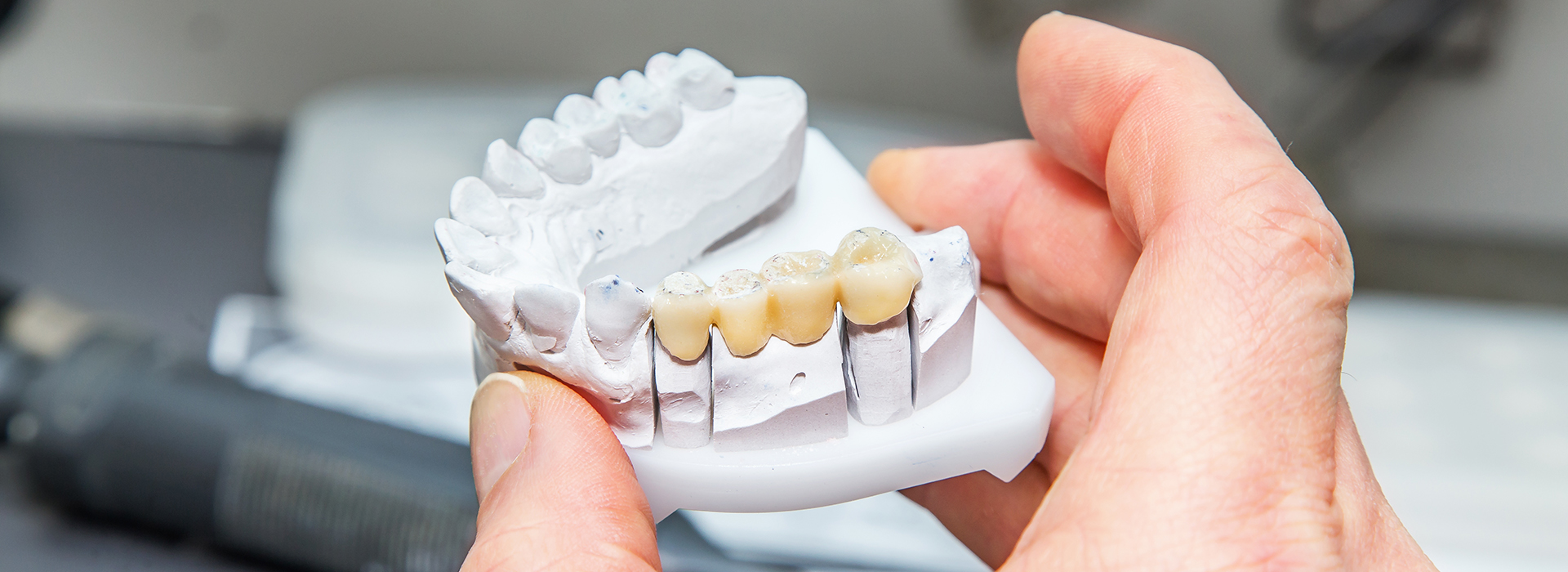 The image shows a person s hand holding a three-dimensional printed model of a human mouth with teeth and gums, indicating a focus on dental technology or 3D printing applications in dentistry.