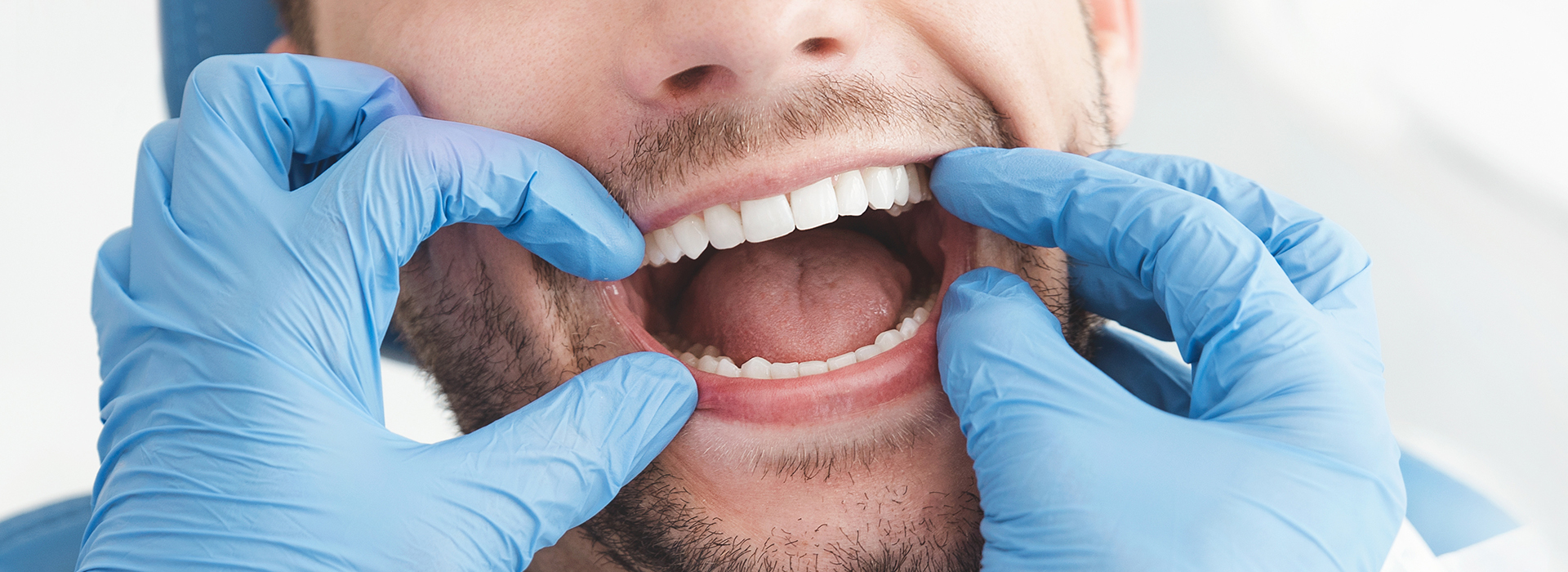 The image shows a smiling man with his mouth open wide, wearing blue gloves and a white mask, likely a dental professional, in front of a blurred background that suggests a medical setting.