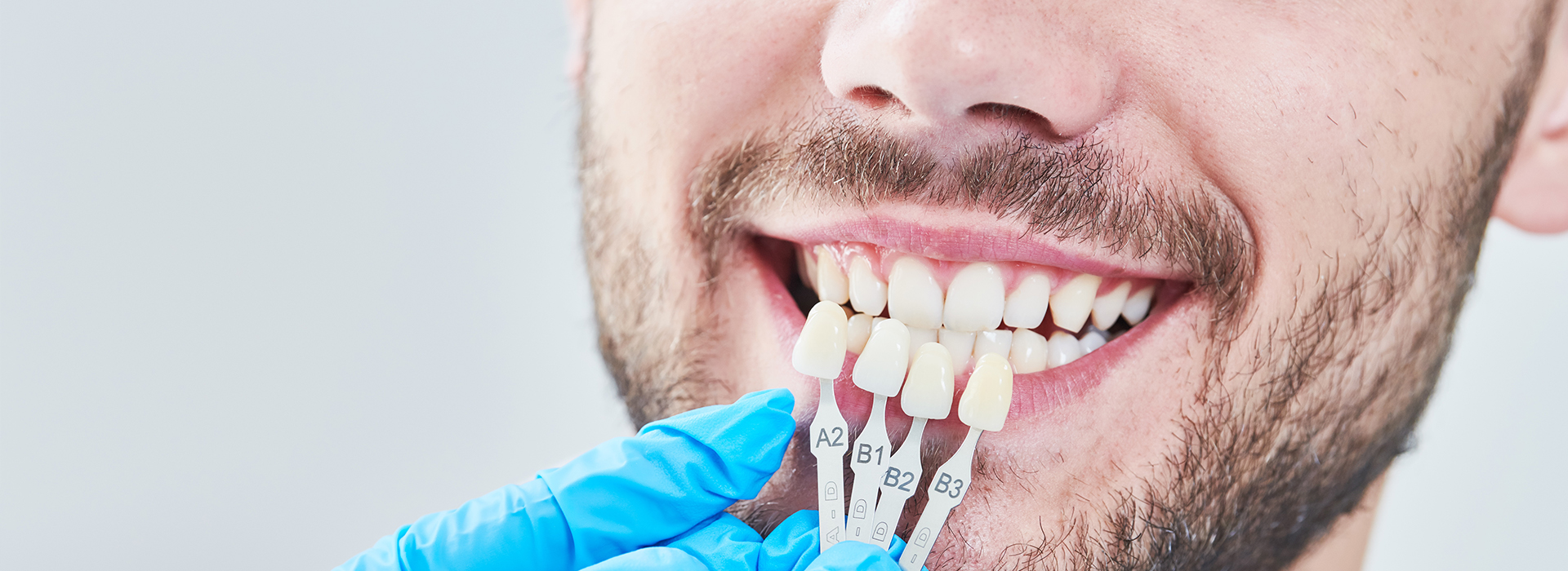 The image shows a man with a toothy grin, wearing a white lab coat, holding up a clear plastic tray containing a set of teeth with a visible gap where one tooth is missing, and he appears to be in a dental office environment.